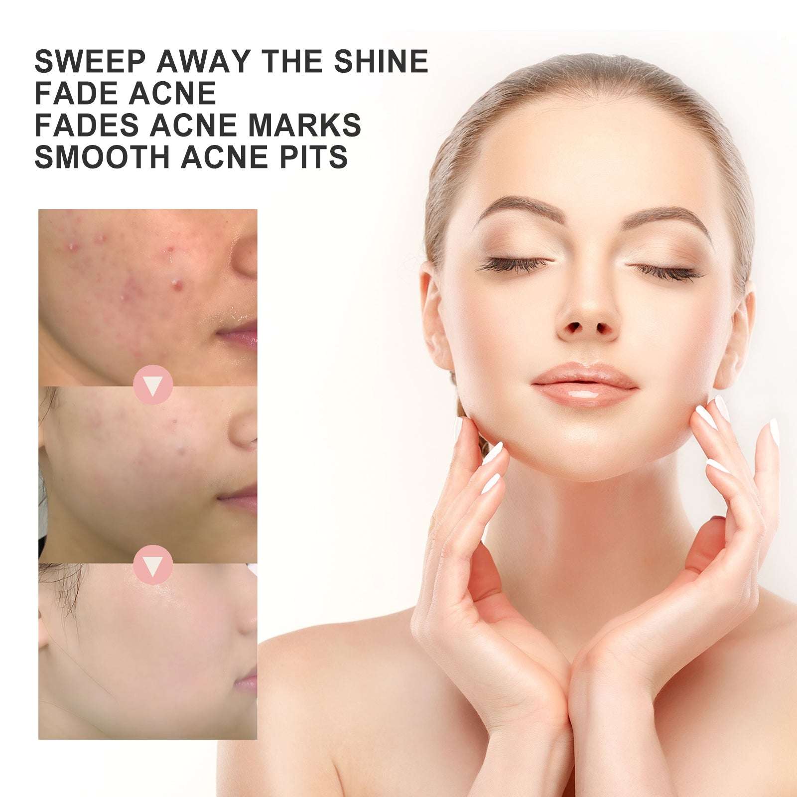 OUHOE Acne Patch Repair Acne Acne Redness Pore Cleansing & Moisturizing Patch